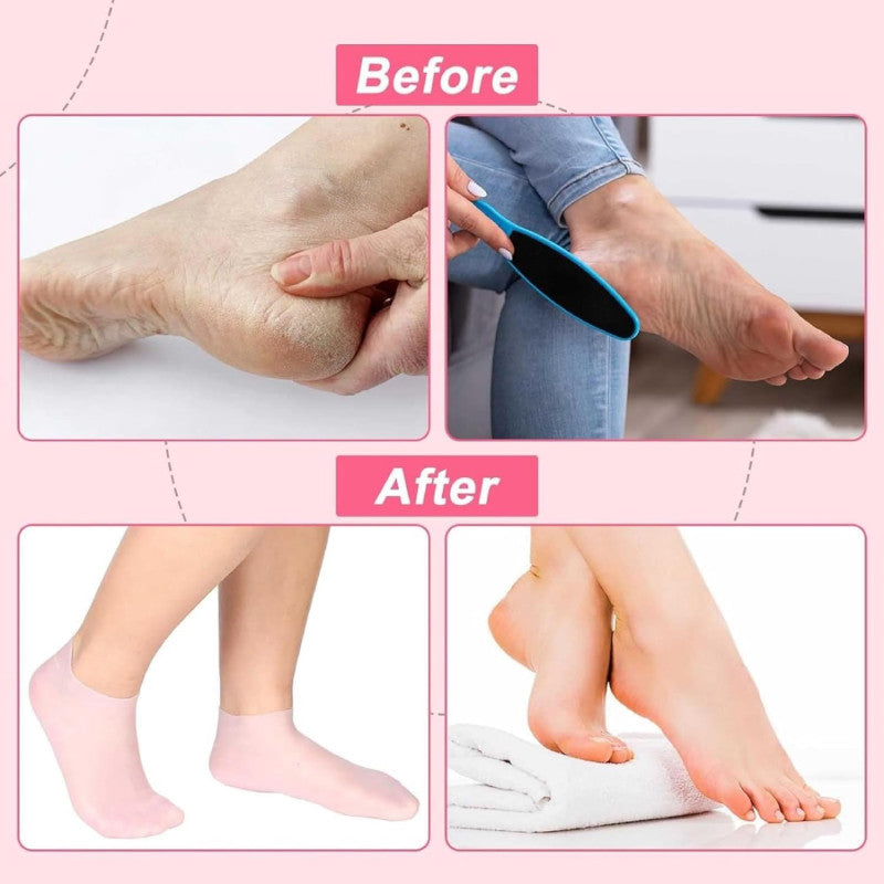 1 Pair Silicone Moisturizing Gel feet Socks